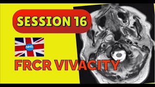 FRCR VIVACITY SESSION 16 [upl. by Nnylakcaj]