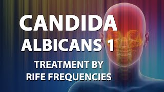 Candida Albicans 1 Candidiasis  Rife Frequencies  Energy amp Quantum Medicine  Bioresonance [upl. by Naginnarb]