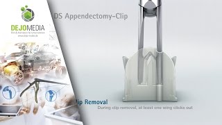 AESCULAP  Produktfilm  DS Appendectomy  Removal [upl. by Adias]