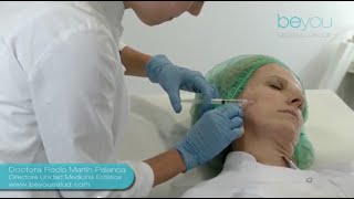 Mesoterapia Facial Tratamiento de medicina estética [upl. by Aihsenot337]