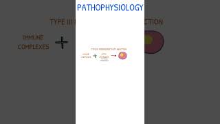 SYSTEMIC LUPUS ERYTHEMATOSUS  Pathophysiology [upl. by Nonek]