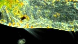 Microscopic Worm With Spinning Food Particle In its Head OMG [upl. by Wally]