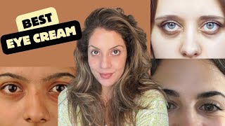 Best Eye Treatment for Texture Veins Milia under Eyes I Top 5 eye creams  Nipun Kapu [upl. by Ewall387]