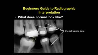 Radiographic Interpretation Section 1 [upl. by Suzanna58]