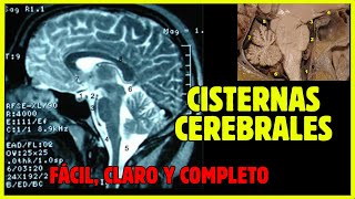 🧠 CISTERNAS CEREBRALES  Anatomía de las cisternas subaracnoideas fácil y completo [upl. by Esela]