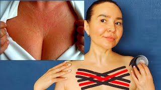 Chest Wrinkles How to Remove and Prevent with Kinesio Taping [upl. by Anikas]