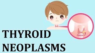 23 Thyroid neoplasms [upl. by Needan]