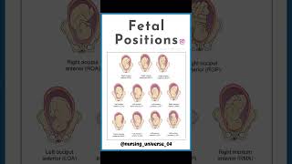 FETAL POSITIONS 🚼🤰🏻 [upl. by Htabmas]