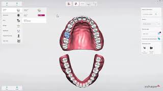 Introduction to 3Shape TRIOS on Dental Desktop [upl. by Karel]