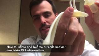 How to InflateDeflate a Penile Implant [upl. by Mairim]