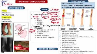 Fracturas Generalidades  Ortopedia y Traumatología Clases Qx Medic  01 [upl. by Salta]