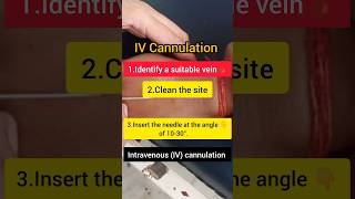 IV Cannulation Steps doctor nursing youtubeshorts mbbs paramedical Aiims [upl. by Volding75]