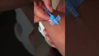 I v cannula youtube viralshort trending viralshort viralreels [upl. by Haral]