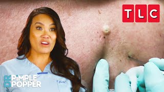 The BEST Blackhead Pops  Dr Pimple Popper  TLC [upl. by Gal759]