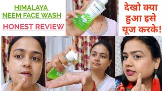 HIMALAYA NEEM FACE WASH  Honest review on Himalaya purifying neem face wash  Acne Pimples Problem [upl. by Jeramie]