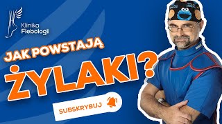 Żylaki  jak powstają [upl. by Janaya]