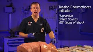 Emergency Turkel Needle Chest Decompression Procedure Explained [upl. by Hardan]