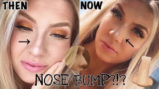 HOW TO USE HIGHLIGHTER TO HIDE NOSE BUMP [upl. by Nodnelg]