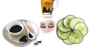 Home Remedies for Dark Circles Under Eyes [upl. by Ydnagrub]