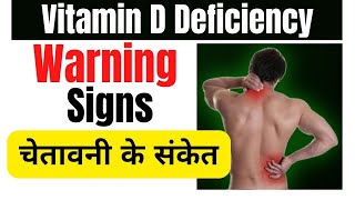 Vitamin D ki deficiency se kya hota hai  Signs and symptoms of vitamin d deficiency [upl. by Lasser]