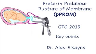 pPROM  GTG 2019 [upl. by Candra]