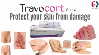 Travocort cream benefits and full review in UrduHindi [upl. by Sidnac563]