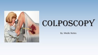 OampG Colposcopy  for medical students indications procedure abnormal results [upl. by Nirtiak]