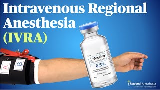 IVRA Intravenous Regional Anesthesia Theory tips and tricks [upl. by Gurney321]