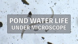 Pond water microorganism under microscope [upl. by Htebasile]