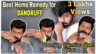 Reason For Dandruff and How to Cure it  Home Remedy  No side effects  Tamil  English  Shadhik [upl. by Werdna]