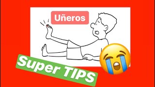 UÑA ENCARNADA 👨🏻‍🔬 UÑEROS 👩‍🔬 ONICOCRIPTOSIS 💪 6 SUPER CONSEJOS [upl. by Haim]