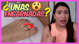 ¿Cómo SACAR una UÑA ENCARNADA HÁZLO como PROFESIONAL ✅  Curso De Uñas 012 [upl. by Abbub1]