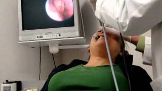 FinESS Sinus Treatment  Physician Instructional Video [upl. by Burl641]