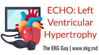 Left ventricular hypertrophy  ECHO Course l The EKG Guy video [upl. by Mandle687]