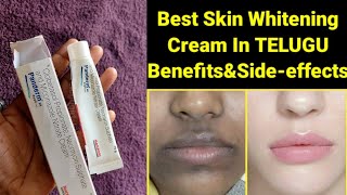 panderm skin whitening Cream review demo and live results in Telugu  Telugugirlchannel Sruthi [upl. by Chimene792]