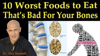 10 Worst Foods to Eat Thats Bad for Your Bones Osteoporosis  Dr Alan Mandell DC [upl. by Thunell]