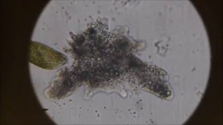 The BlobAmoeba proteus under the microscope [upl. by Annim490]