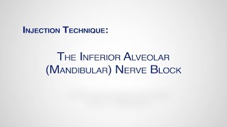 Module Inferior Alveolar Mandibular Nerve Block Injection [upl. by Rexferd]