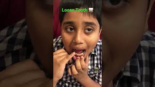 Loose Tooth 🦷 pulling [upl. by Odilo]