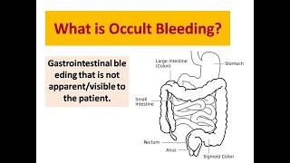 How to Approach Occult Gastrointestinal Bleeding  What is Fecal Occult Blood Test [upl. by Peter68]