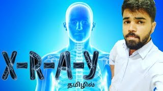 How xray works in tamil  CT Scan  MRI Scan  X Ray  Tamil  Learn Tech [upl. by Siednarb105]