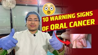 10 warning signs of oral cancer [upl. by Dacia]