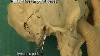 17 Step 1 Parts of the adult temporal bone petrotympanic fissure [upl. by Snahc]