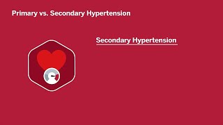 Evaluation of Secondary Hypertension [upl. by Acinoj]