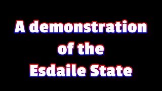 The Esdaile  Coma State demonstration  Deep Hypnosis Phenomena [upl. by Leirea]