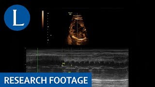 Diagnostic Accuracy of Fetal Growth Charts in Predicting Fetal Growth Restriction in Third Trimester [upl. by Fugazy795]