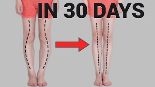 Get Straight Legs in 30 Days Fix O or XShaped Legs Knee Internal Rotation [upl. by Jeu]