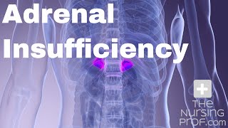 Adrenal Insufficiency [upl. by Nawrocki]