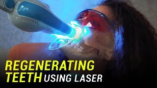 Researchers use lasers to regenerate teeth from stem cells [upl. by Burkhard752]