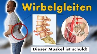 Gleitwirbel Wirbelgleiten wegtrainieren  GENAUE Ursache und 1 Übungen die NACHHALTIG hilft [upl. by Jobyna382]